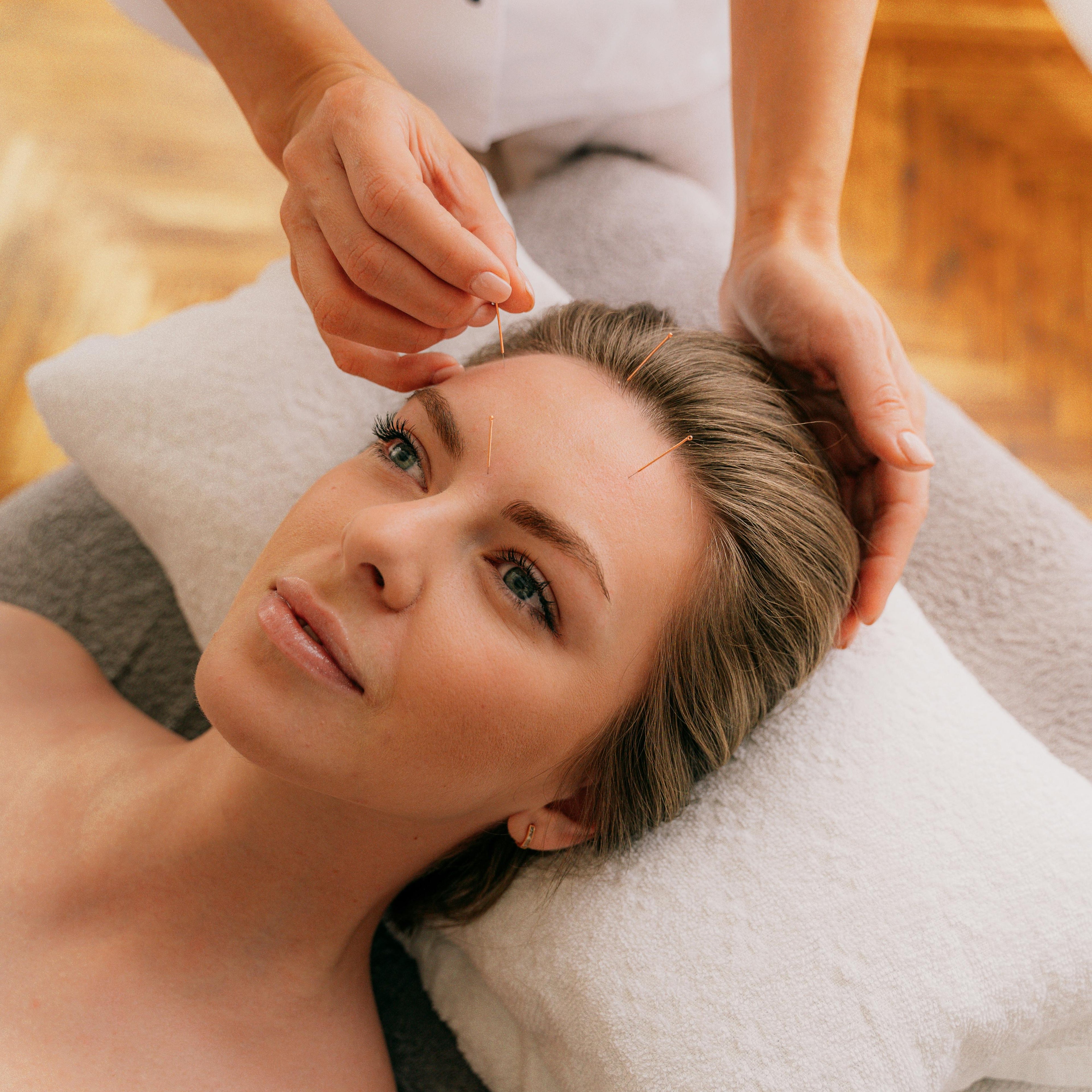 Aesthetic Acupuncture